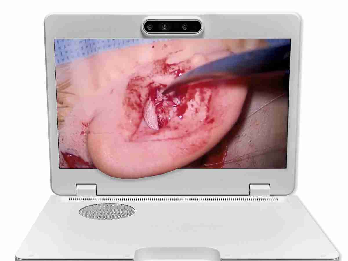 达擎之＂Heads-up 3D显微手术显示系统＂，，整合4K裸眼3D显示及眼球追踪系统，，，具备快速追踪人眼移动位置功能，，，减轻医师长时间维持固定姿势的负担，，让医师能有更宽广清晰的3D立体视野及更舒适的姿势来执行手术。。。。